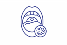 تانسیلیت